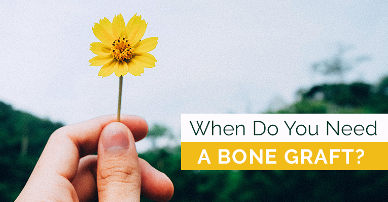 When do you need a bone graft?